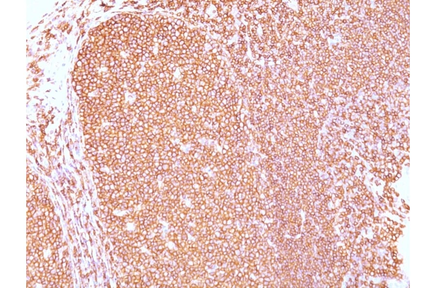 Immunohistochemistry - Anti-CD45RB Antibody [PD7/26] - BSA and Azide free (A252987) - Antibodies.com
