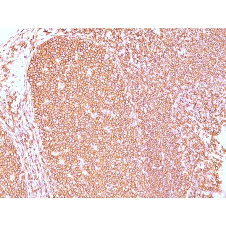 Immunohistochemistry - Anti-CD45RB Antibody [PD7/26] - BSA and Azide free (A252987) - Antibodies.com