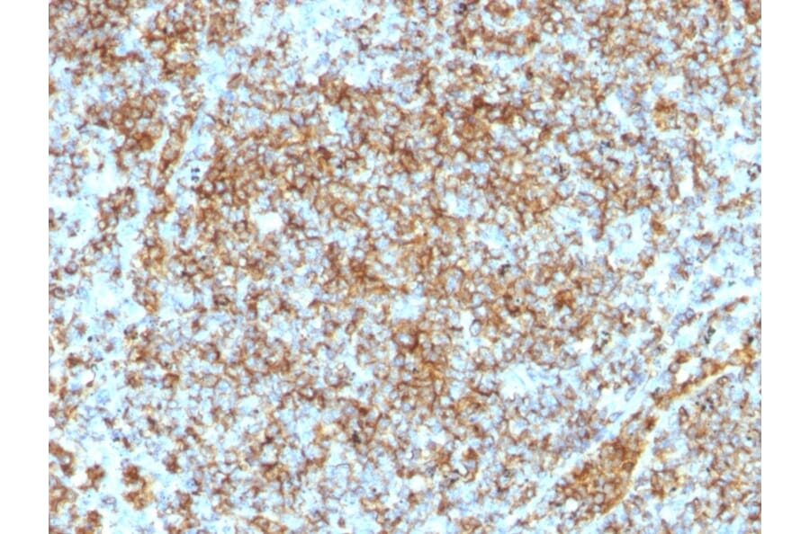 Immunohistochemistry - Anti-CD45RB Antibody [SPM569] - BSA and Azide free (A252987) - Antibodies.com