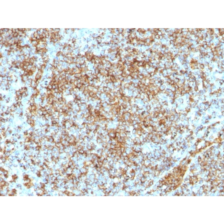 Immunohistochemistry - Anti-CD45RB Antibody [SPM569] - BSA and Azide free (A252987) - Antibodies.com