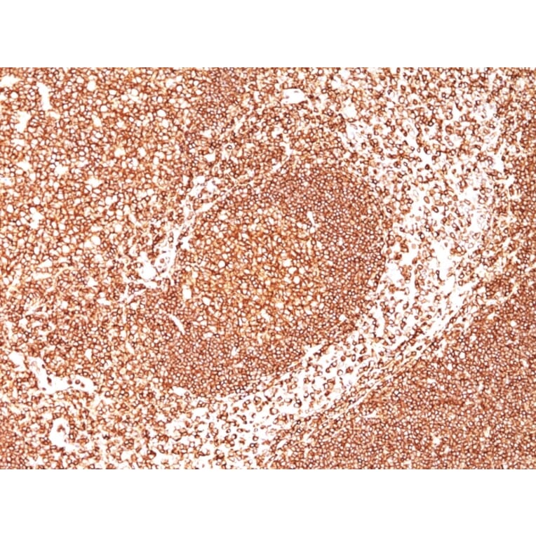 Immunohistochemistry - Anti-CD45 Antibody [2B11 + PD7/26] - BSA and Azide free (A252989) - Antibodies.com