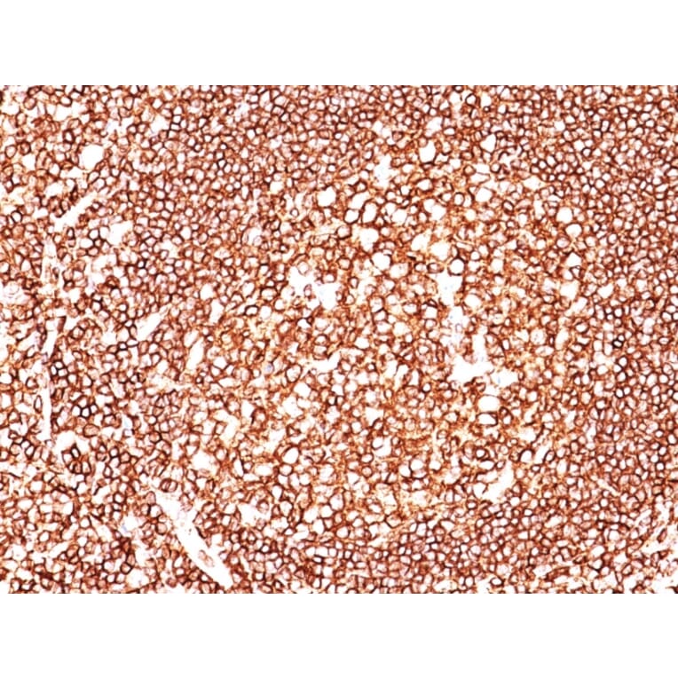 Immunohistochemistry - Anti-CD45 Antibody [2B11 + PD7/26] - BSA and Azide free (A252989) - Antibodies.com