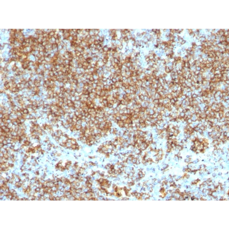 Immunohistochemistry - Anti-CD45 Antibody [SPM569 + SPM570] - BSA and Azide free (A252989) - Antibodies.com
