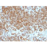 Immunohistochemistry - Anti-CD45 Antibody [SPM569 + SPM570] - BSA and Azide free (A252989) - Antibodies.com