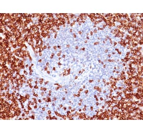 Immunohistochemistry - Anti-CD45RO Antibody [T200/797] - BSA and Azide free (A252992) - Antibodies.com