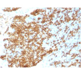 Immunohistochemistry - Anti-CD45RB Antibody [PTPRC/1783R] - BSA and Azide free (A252996) - Antibodies.com