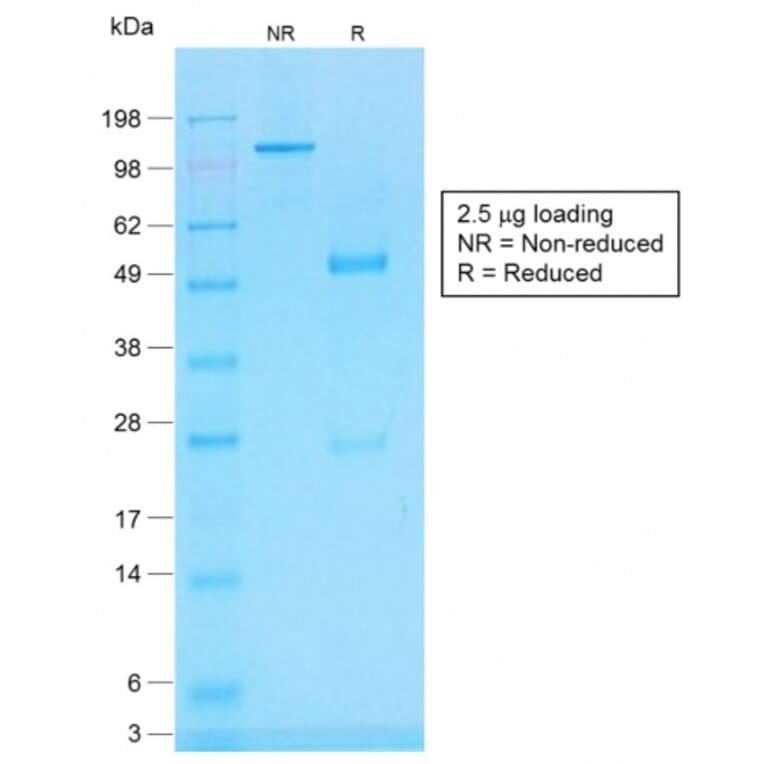 SDS-PAGE - Anti-CD45RB Antibody [PTPRC/1783R] - BSA and Azide free (A252996) - Antibodies.com