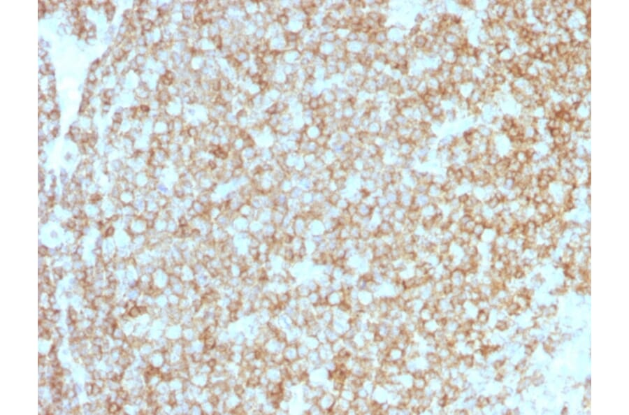 Immunohistochemistry - Anti-CD45 Antibody [PTPRC/1783R + PTPRC/1975R] - BSA and Azide free (A252997) - Antibodies.com