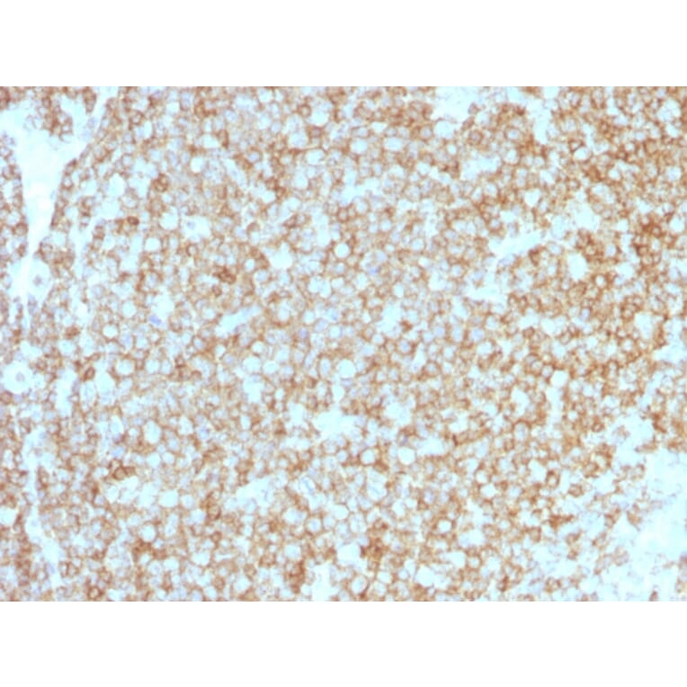 Immunohistochemistry - Anti-CD45 Antibody [PTPRC/1783R + PTPRC/1975R] - BSA and Azide free (A252997) - Antibodies.com