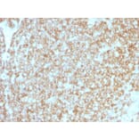 Immunohistochemistry - Anti-CD45 Antibody [PTPRC/1783R + PTPRC/1975R] - BSA and Azide free (A252997) - Antibodies.com