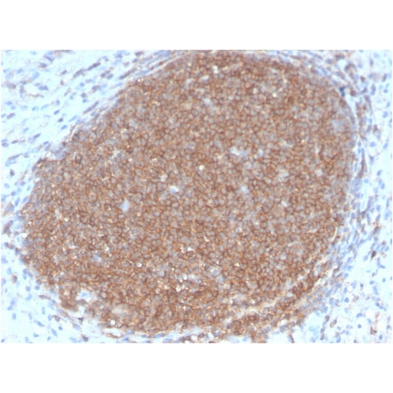 Immunohistochemistry - Anti-CD45RB Antibody [PTPRC/2877R] - BSA and Azide free (A252999) - Antibodies.com