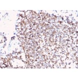 Immunohistochemistry - Anti-CD45 Antibody [PTPRC/3881R] - BSA and Azide free (A252999) - Antibodies.com