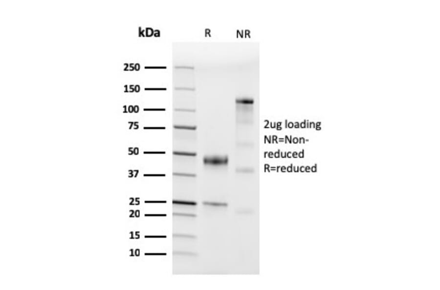 SDS-PAGE - Anti-CD45 Antibody [PTPRC/3881R] - BSA and Azide free (A253000) - Antibodies.com