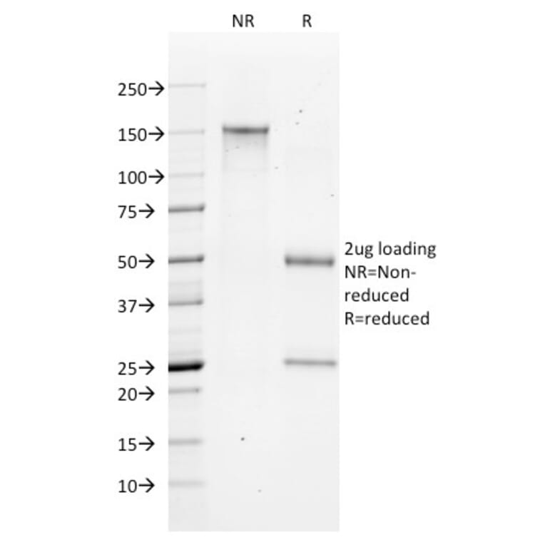 SDS-PAGE - Anti-Bax Antibody [2D2] - BSA and Azide free (A253002) - Antibodies.com
