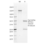 SDS-PAGE - Anti-Bax Antibody [2D2] - BSA and Azide free (A253002) - Antibodies.com