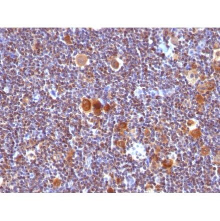 Immunohistochemistry - Anti-Bax Antibody [SPM336] - BSA and Azide free (A253003) - Antibodies.com