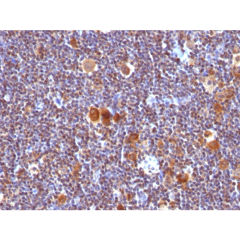 Immunohistochemistry - Anti-Bax Antibody [SPM336] - BSA and Azide free (A253003) - Antibodies.com