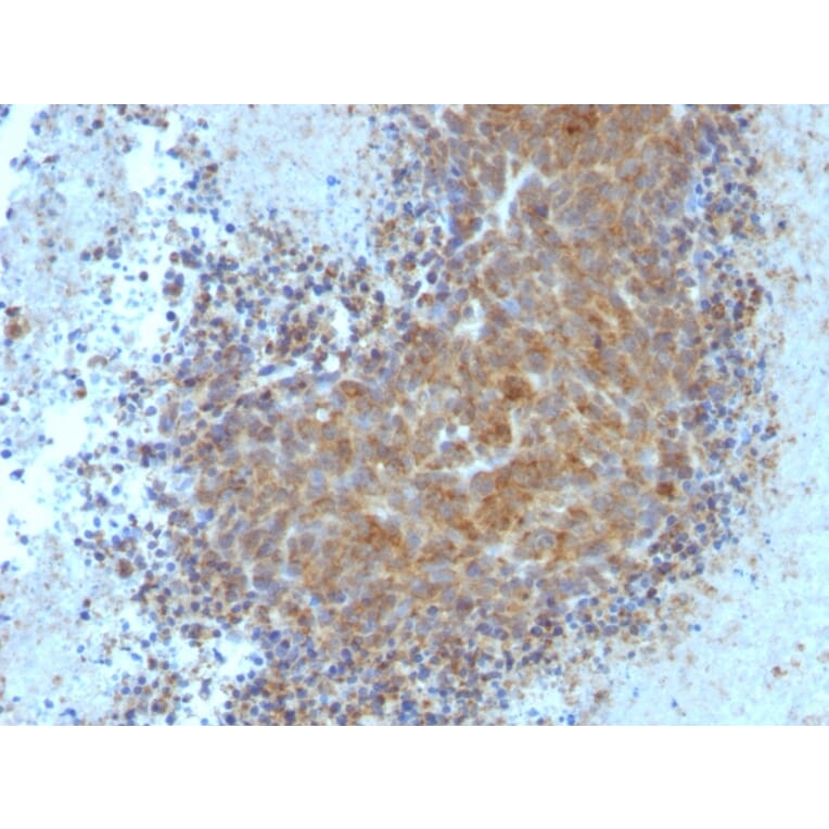 Immunohistochemistry - Anti-Bax Antibody [BAX/962] - BSA and Azide free (A253004) - Antibodies.com