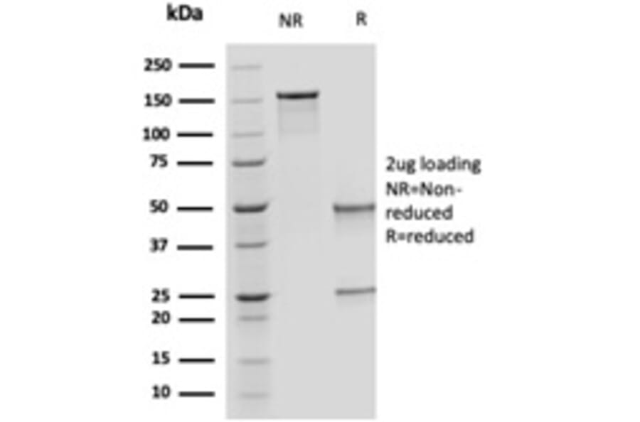 SDS-PAGE - Anti-OVOL2 Antibody [PCRP-OVOL2-2A1] - BSA and Azide free (A253006) - Antibodies.com