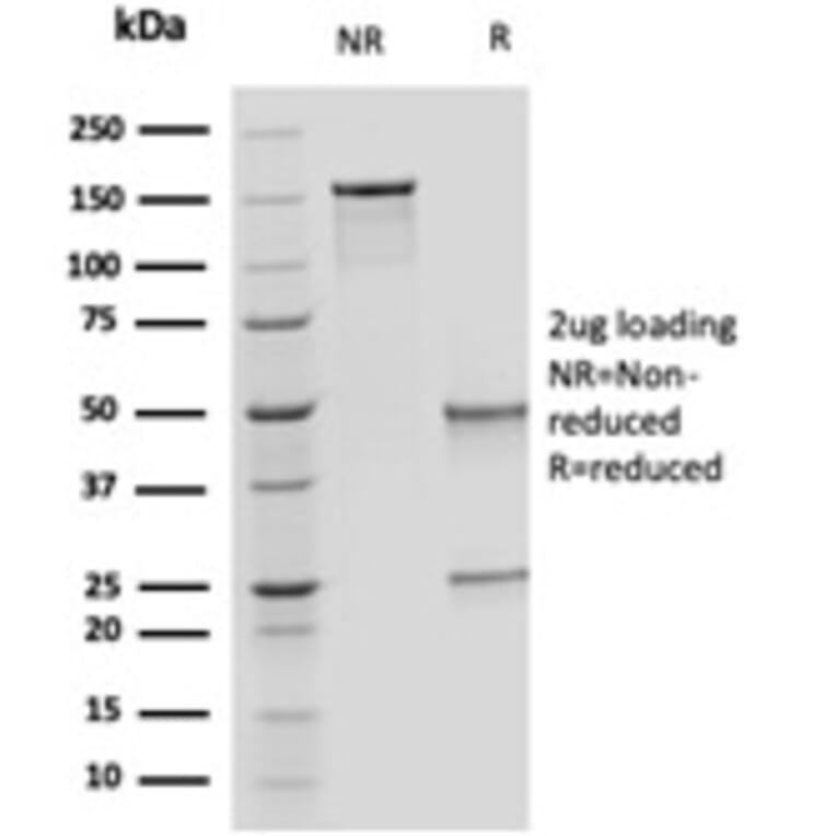 SDS-PAGE - Anti-OVOL2 Antibody [PCRP-OVOL2-2A1] - BSA and Azide free (A253006) - Antibodies.com