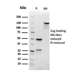 SDS-PAGE - Anti-RAC1 Antibody [CPTC-RAC1-1] - BSA and Azide free (A253007) - Antibodies.com