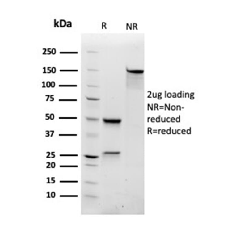 SDS-PAGE - Anti-RAC1 Antibody [CPTC-RAC1-1] - BSA and Azide free (A253007) - Antibodies.com