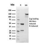 SDS-PAGE - Anti-RAC1 Antibody [CPTC-RAC1-1] - BSA and Azide free (A253007) - Antibodies.com