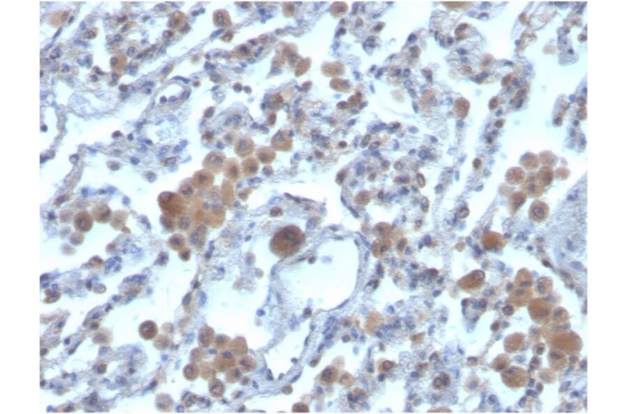 Immunohistochemistry - Anti-RAC1 Antibody [CPTC-RAC1-1] - BSA and Azide free (A253007) - Antibodies.com