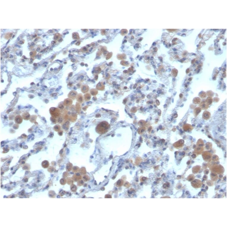 Immunohistochemistry - Anti-RAC1 Antibody [CPTC-RAC1-1] - BSA and Azide free (A253007) - Antibodies.com