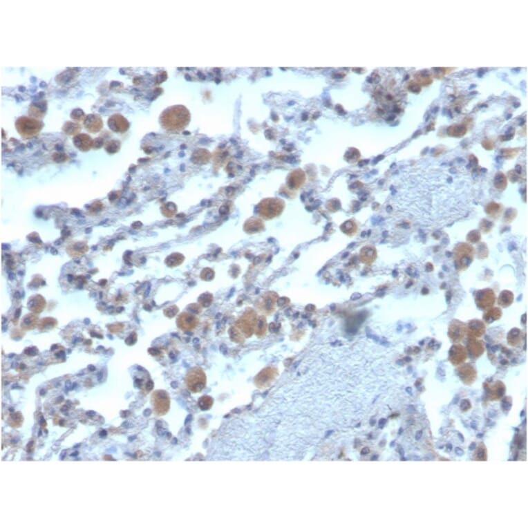 Immunohistochemistry - Anti-RAC1 Antibody [CPTC-RAC1-1] - BSA and Azide free (A253007) - Antibodies.com