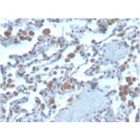 Immunohistochemistry - Anti-RAC1 Antibody [CPTC-RAC1-1] - BSA and Azide free (A253007) - Antibodies.com