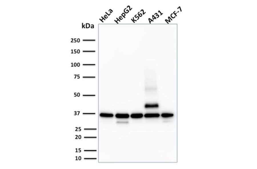 Western Blot - Anti-RAD51 Antibody [RAD51/2701] - BSA and Azide free (A253008) - Antibodies.com
