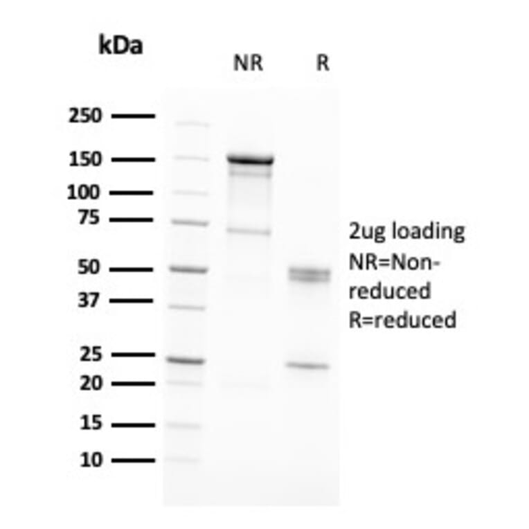 SDS-PAGE - Anti-RAD51 Antibody [RAD51/2701] - BSA and Azide free (A253008) - Antibodies.com