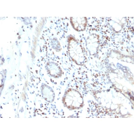 Immunohistochemistry - Anti-RAD51 Antibody [RAD51/2702] - BSA and Azide free (A253009) - Antibodies.com