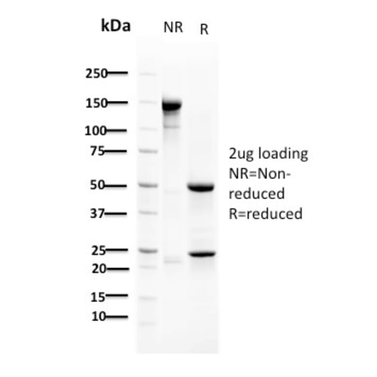 SDS-PAGE - Anti-RAD51 Antibody [RAD51/2702] - BSA and Azide free (A253009) - Antibodies.com