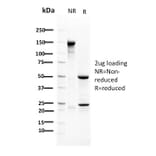 SDS-PAGE - Anti-RAD51 Antibody [RAD51/2702] - BSA and Azide free (A253009) - Antibodies.com