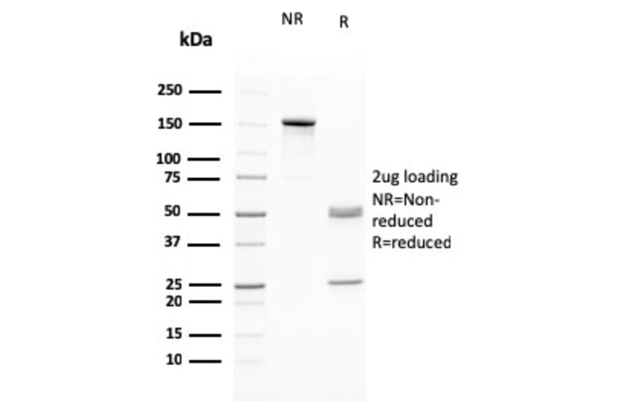 SDS-PAGE - Anti-RAD51 Antibody [RAD51/2765] - BSA and Azide free (A253011) - Antibodies.com