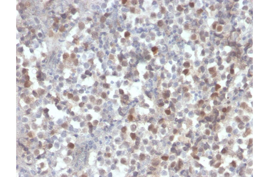 Immunohistochemistry - Anti-RAD51 Antibody [RAD51/2856] - BSA and Azide free (A253012) - Antibodies.com
