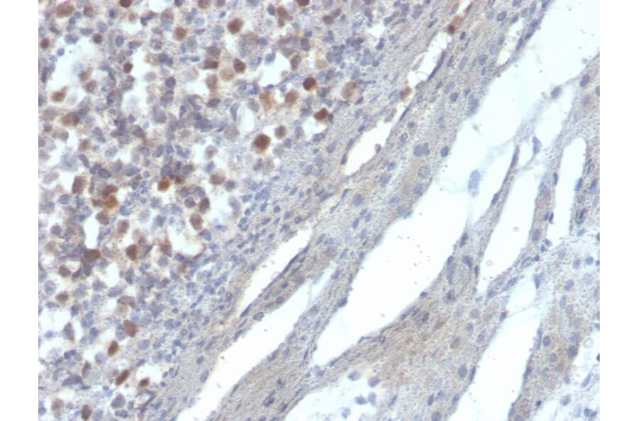Immunohistochemistry - Anti-RAD51 Antibody [RAD51/2856] - BSA and Azide free (A253012) - Antibodies.com