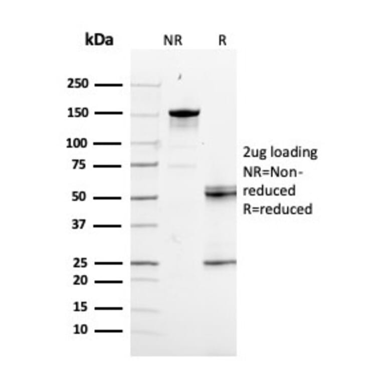 SDS-PAGE - Anti-RAD51 Antibody [RAD51/2856] - BSA and Azide free (A253012) - Antibodies.com