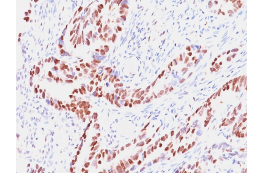 Immunohistochemistry - Anti-Rb1 Antibody [SPM353] - BSA and Azide free (A253013) - Antibodies.com