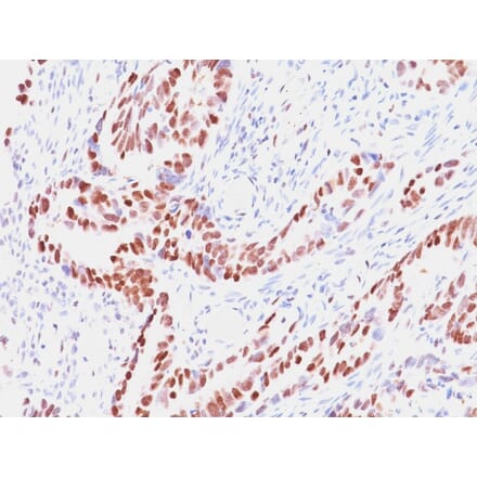 Immunohistochemistry - Anti-Rb1 Antibody [SPM353] - BSA and Azide free (A253013) - Antibodies.com