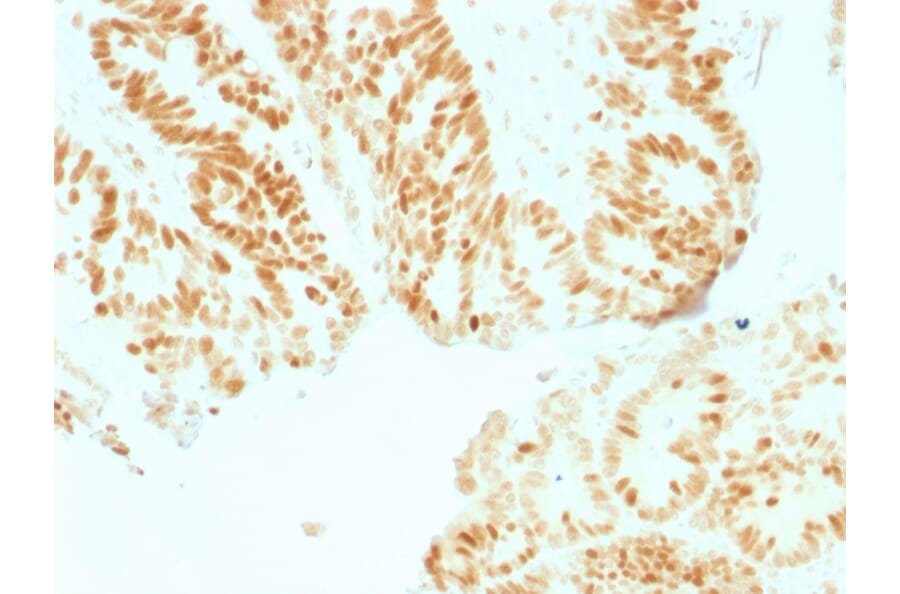 Immunohistochemistry - Anti-Rb1 Antibody [RB1/1754] - BSA and Azide free (A253015) - Antibodies.com