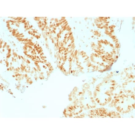 Immunohistochemistry - Anti-Rb1 Antibody [RB1/1754] - BSA and Azide free (A253015) - Antibodies.com