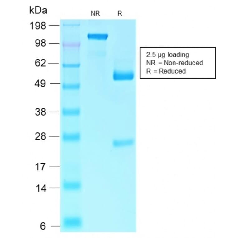 SDS-PAGE - Anti-Rb1 Antibody [RB1/2313R] - BSA and Azide free (A253016) - Antibodies.com