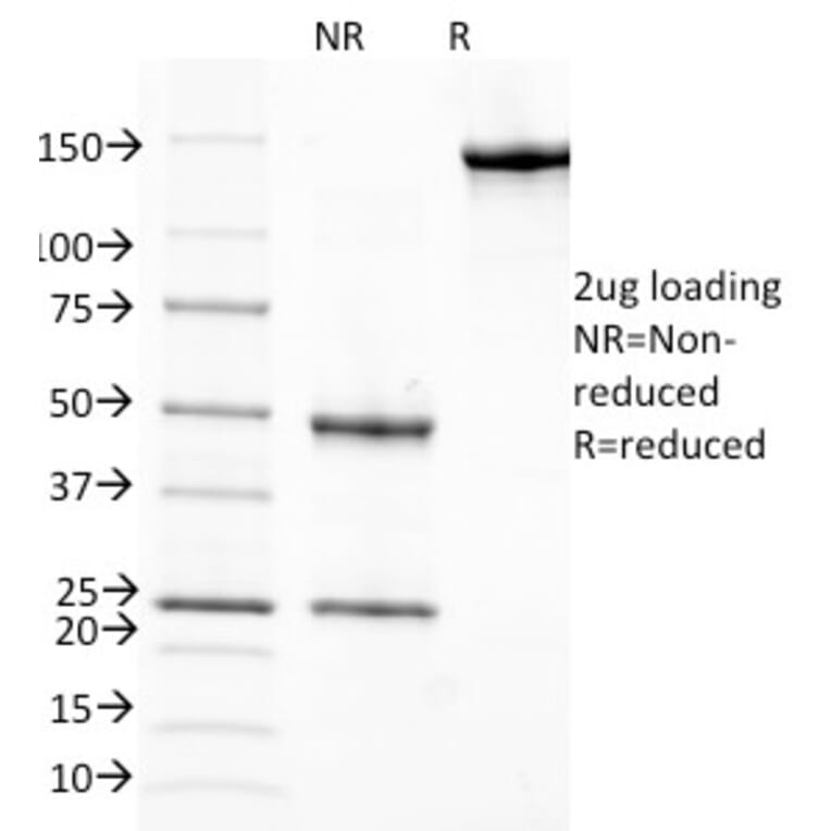 SDS-PAGE - Anti-Retinol Binding Protein Antibody [G4E4] - BSA and Azide free (A253017) - Antibodies.com