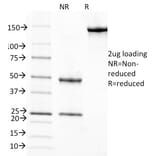 SDS-PAGE - Anti-Retinol Binding Protein Antibody [G4E4] - BSA and Azide free (A253017) - Antibodies.com