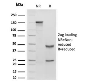 SDS-PAGE - Anti-Retinol Binding Protein Antibody [rRBP1/872] - BSA and Azide free (A253020) - Antibodies.com