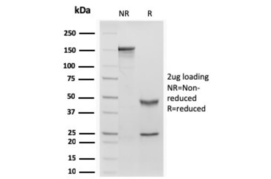 SDS-PAGE - Anti-Retinol Binding Protein Antibody [rRBP1/872] - BSA and Azide free (A253020) - Antibodies.com