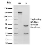 SDS-PAGE - Anti-Retinol Binding Protein Antibody [rRBP1/872] - BSA and Azide free (A253020) - Antibodies.com